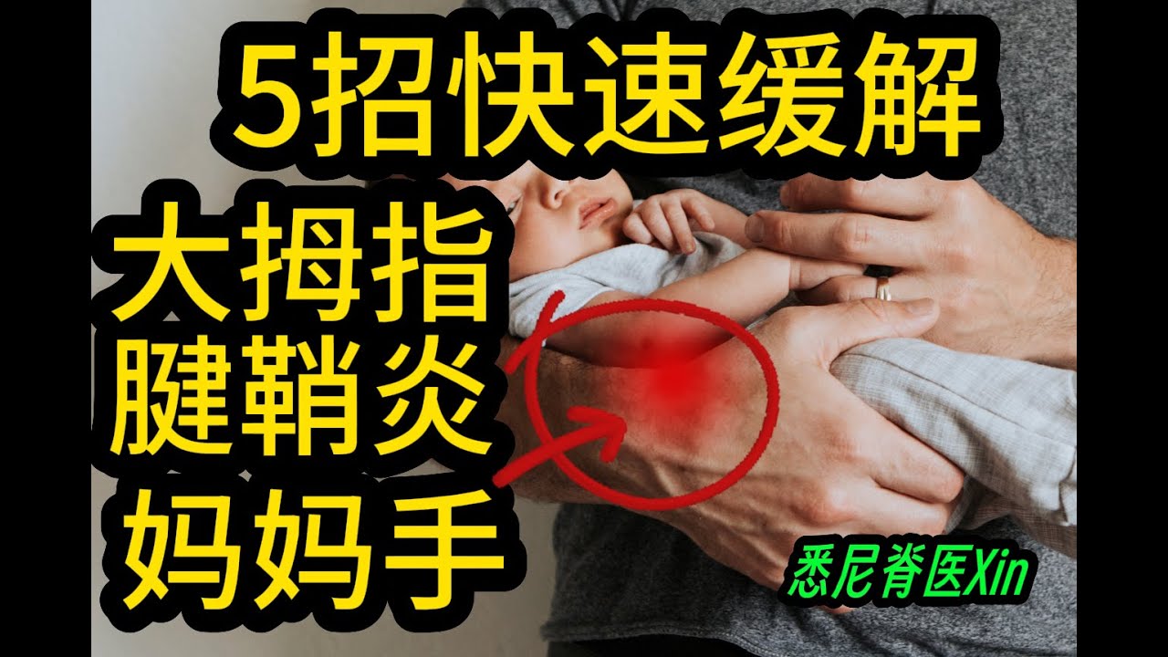 5个动作快速缓解妈妈手/大拇指腱鞘炎｜悉尼脊医Xin