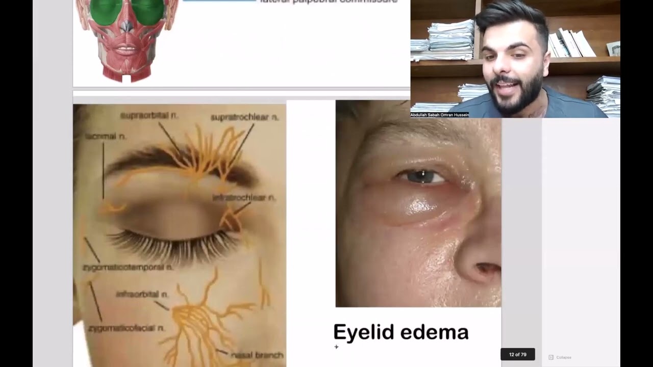 Lecture2 orbital region eyelid ( مرحلة ثانية  طب اسنان - د. عبدالله صباح المنهج الوزاري )