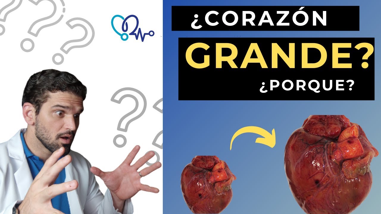 ¿ tengo AGRANDADADO EL CORAZÓN? 😮🚨 ¿Por qué se pudo hacer GRANDE? 💭🤔. ¿Síntomas? mira AQUI TODO👁‍🗨