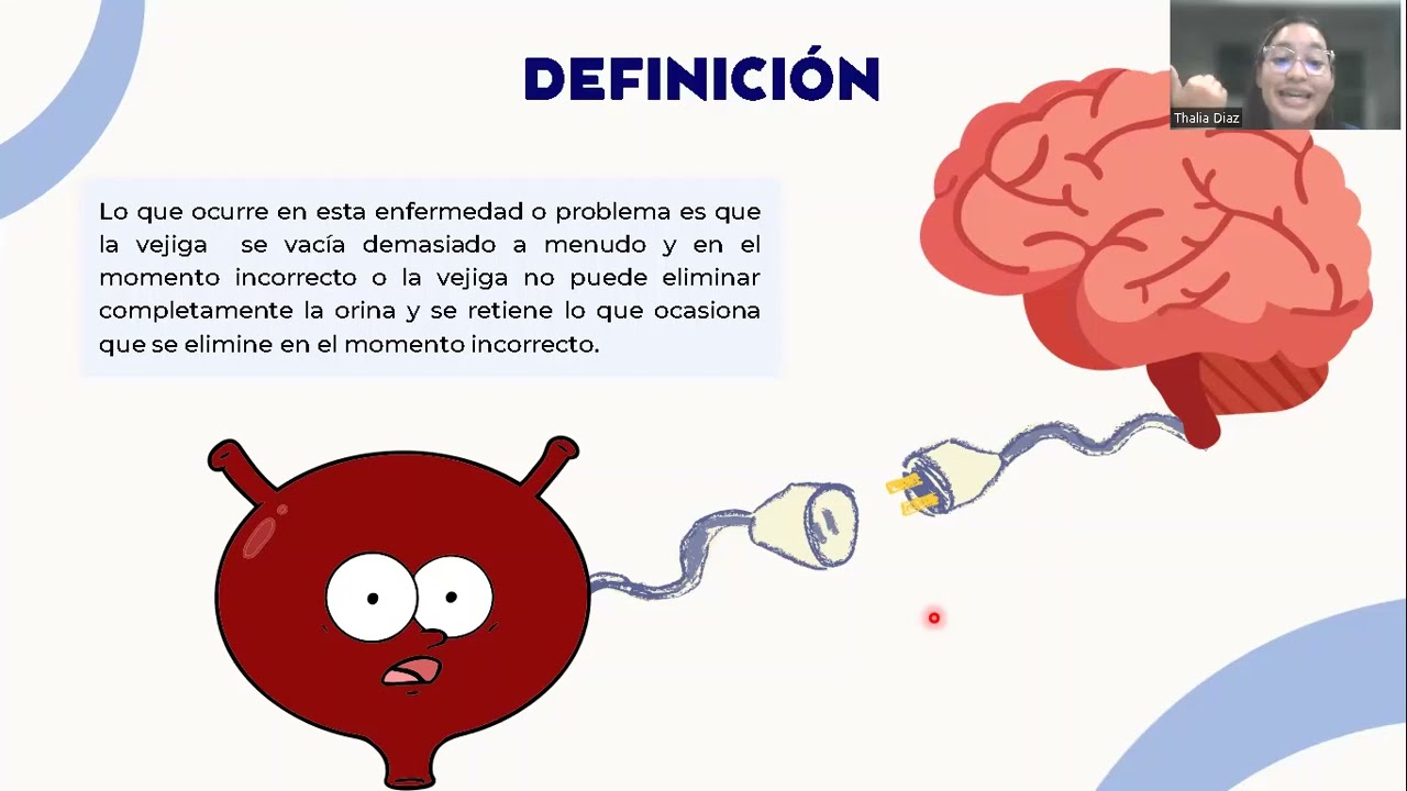 Vejiga neurogénica