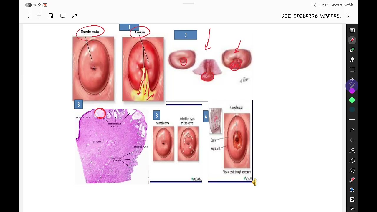 شرح محاضرة رقم ٦١ باثو diseases of F.G.T مع حى الكويز