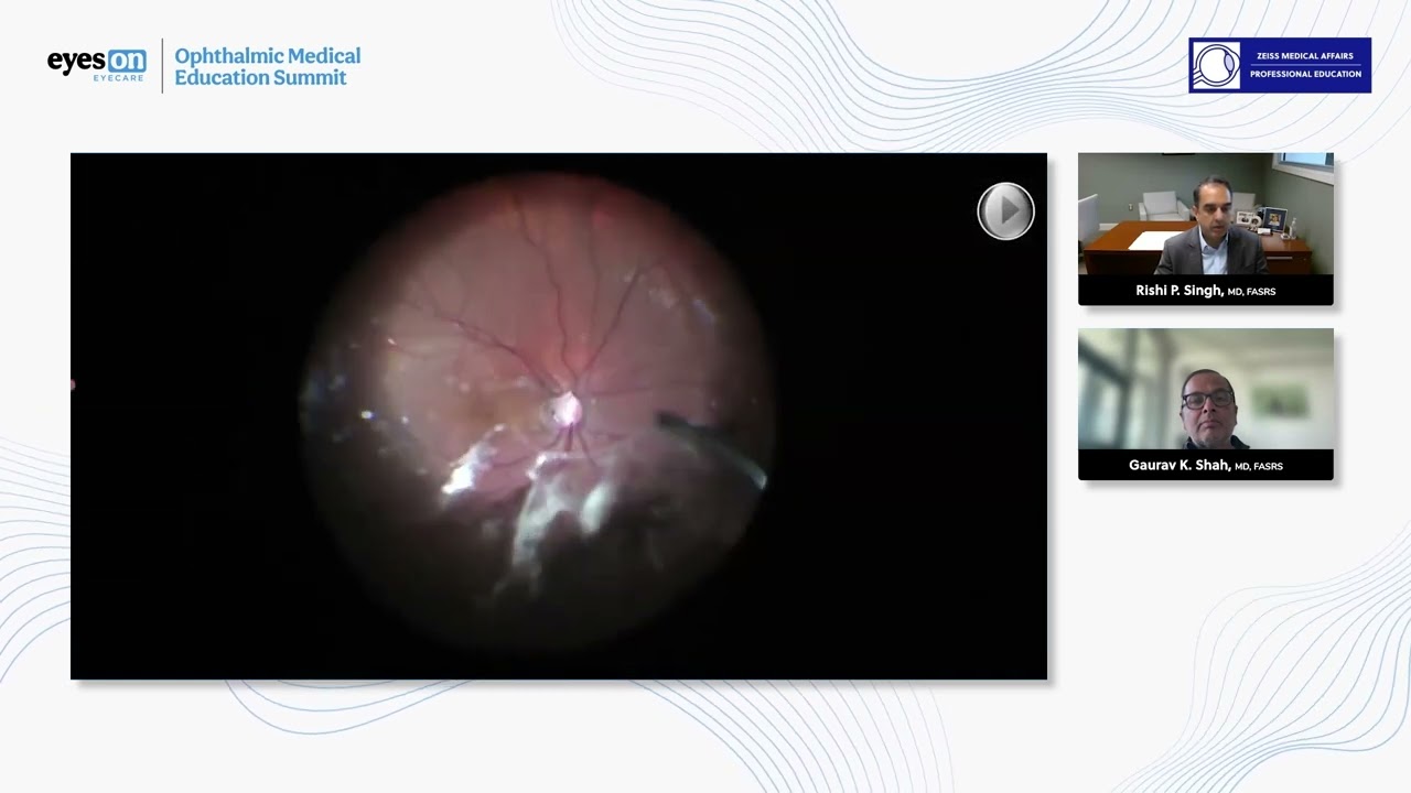 Enhancing Surgical Precision - Preoperative and Intraoperative Imaging Techniques: Case #4