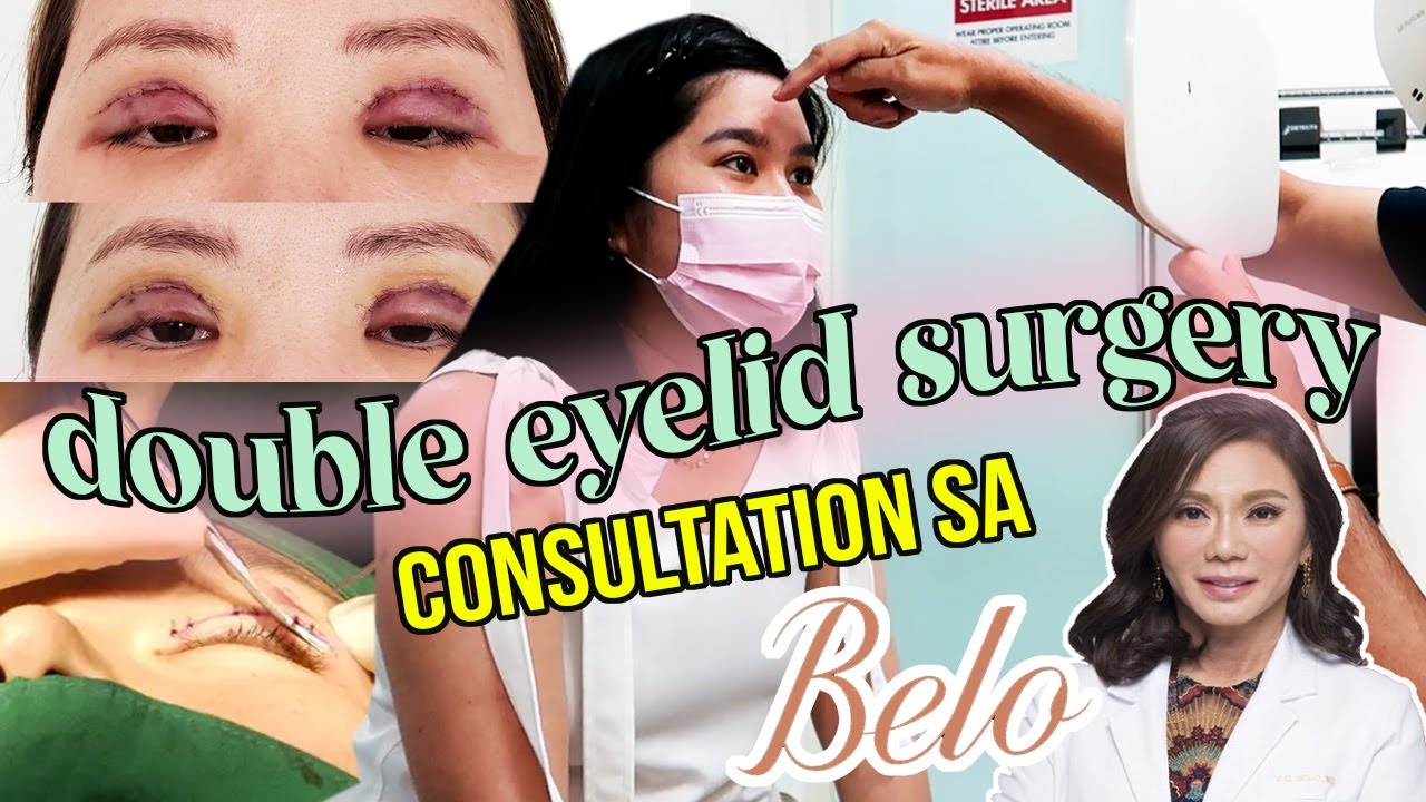 DOUBLE EYELID SURGERY Consultation sa Belo! | Kris Lumagui