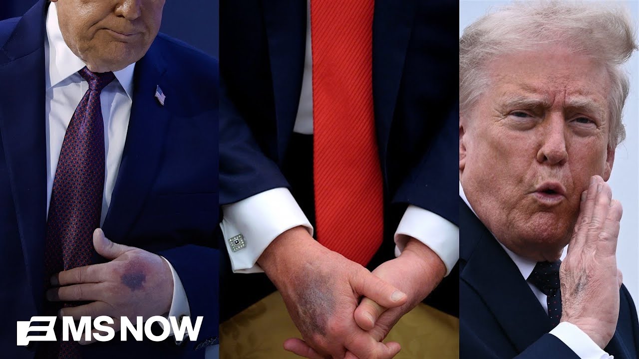 Why aren&rsquo;t Democrats talking about Trump&rsquo;s health?