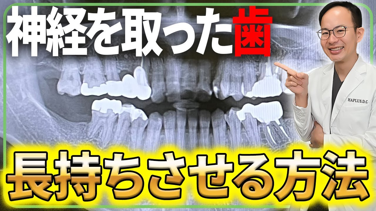 【根管治療】神経の治療をすると歯はめちゃくちゃ弱くなります...歯を失わないため長持ちさせるために気を付けるべきこと
