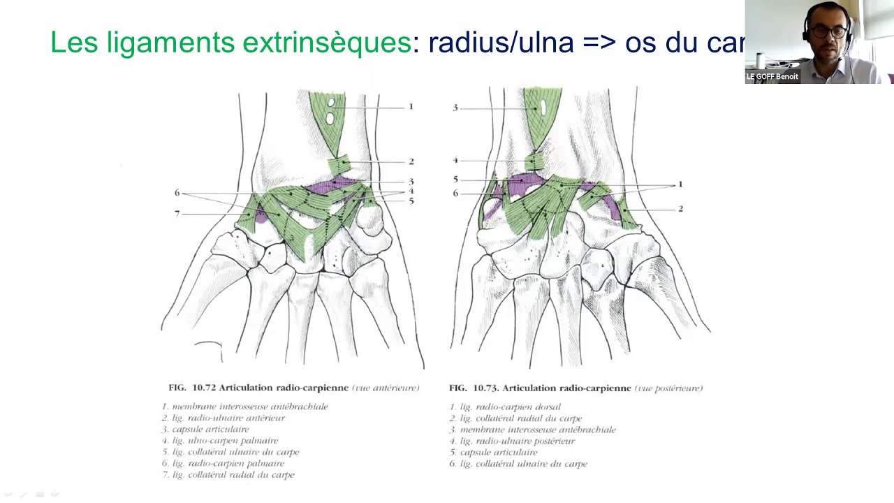 Benoit LE GOFF-Douleurs du poignet d origine ligamentaire quand l évoquer