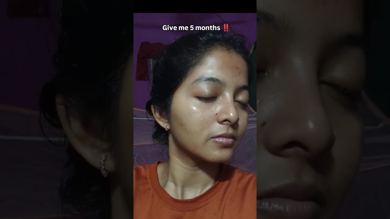 dull skin to glowing skin in 5 months, real  transformation #skincare #transformation #shorts