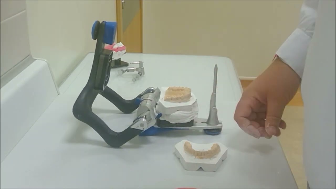 Artex / SAM Articulator