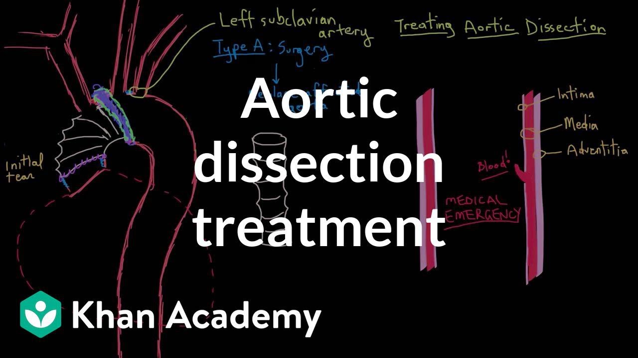 Aortic dissection treatment | Circulatory System and Disease | NCLEX-RN | Khan Academy