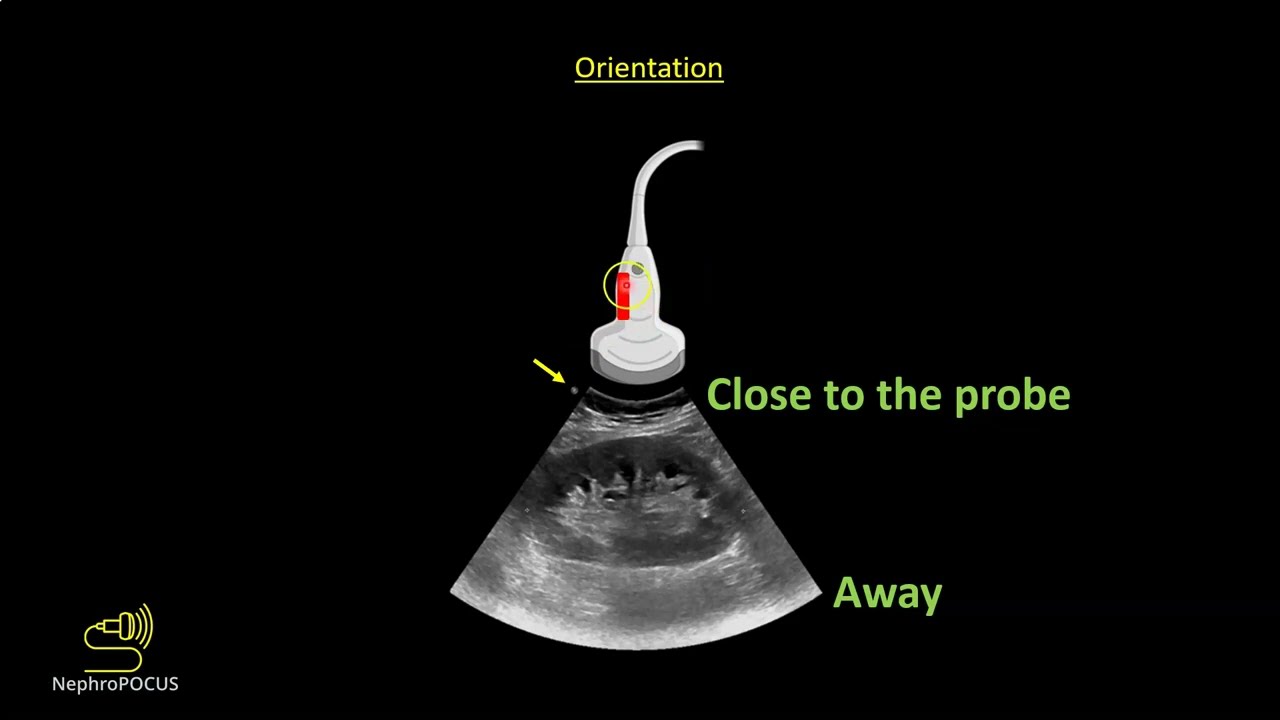 Point-of-care ultrasound (POCUS) Imaging modes and orientation for beginners I Dr. Koratala @NephroP