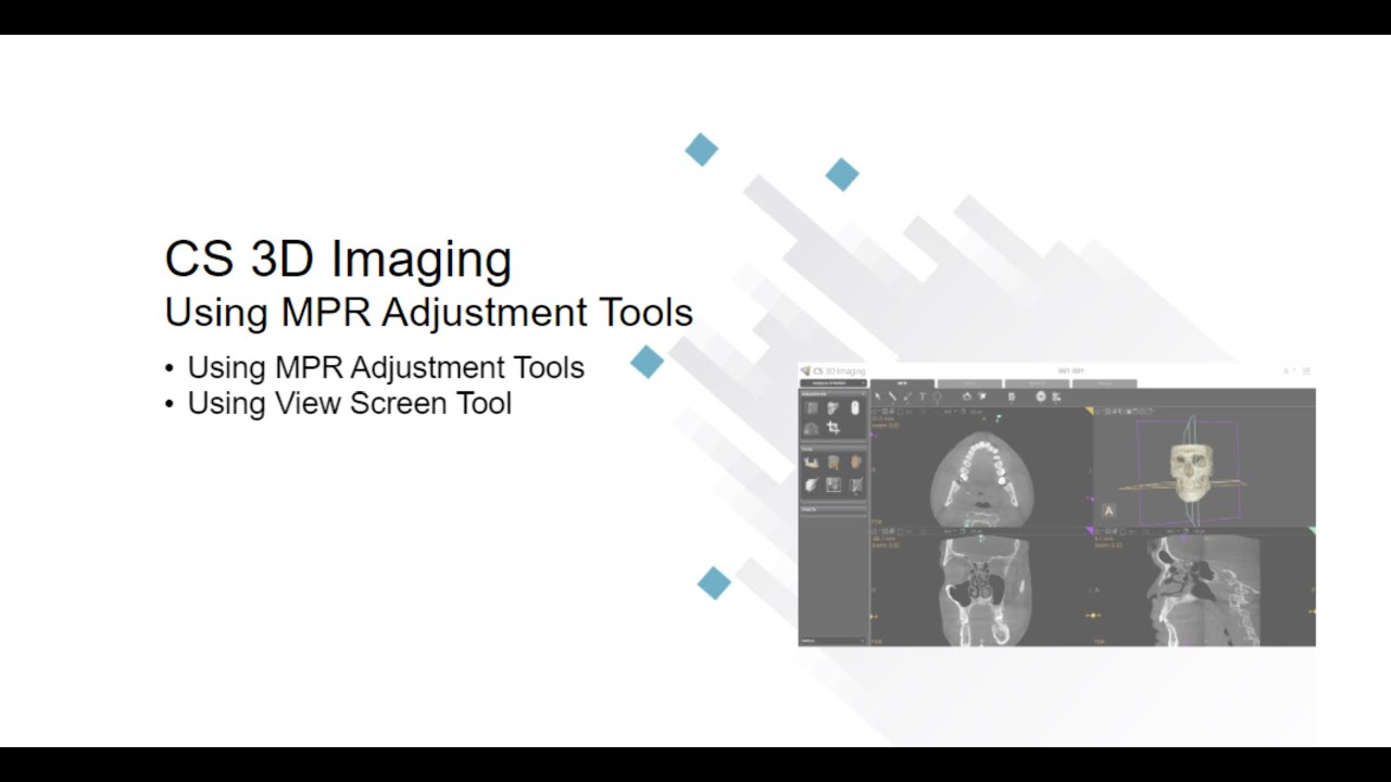 CS 3D Imaging: Using MPR Adjustment Tools Recorded Class