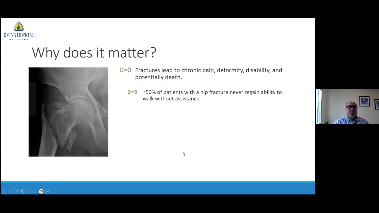 Understanding Osteoporosis: Building Strong Bones