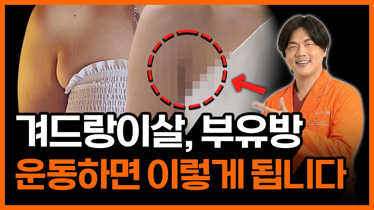 튀어나온 부유방, 겨드랑이살 빨리 빼는 운동법 부터 시술 방법까지 알려 드립니다! (앞볼록 빼는 운동/겨드랑이 살 빨리 빼는법/부유방 지방삭제시술)
