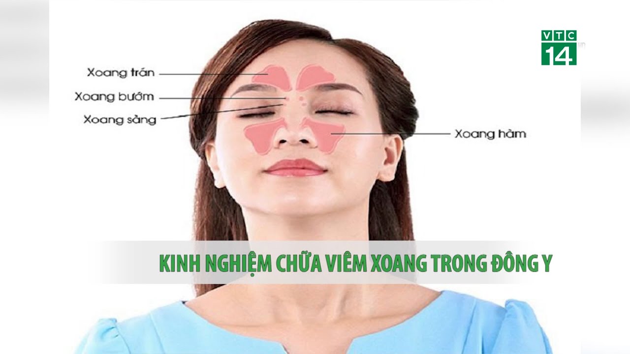 Kinh nghiệm chữa viêm xoang trong Đông y| VTC14