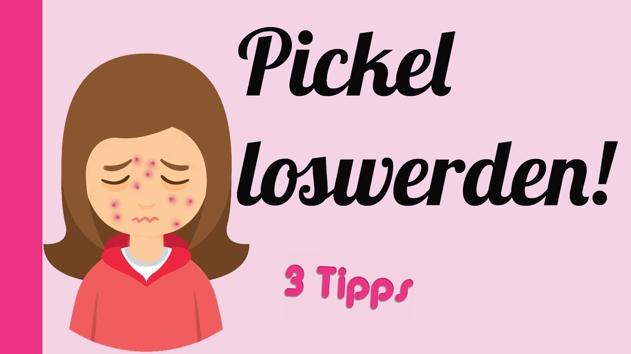 Pickel loswerden👍/ Pickel entfernen statt abdecken - 3 Tipps f&uuml;r starke M&auml;dchen