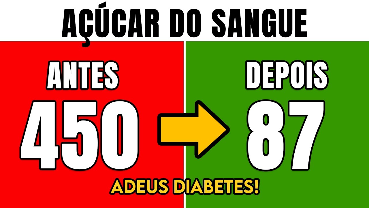 10 ALIMENTOS para BAIXAR A GLICOSE RAPIDAMENTE - Aula 10 | Dr. Turí Souza