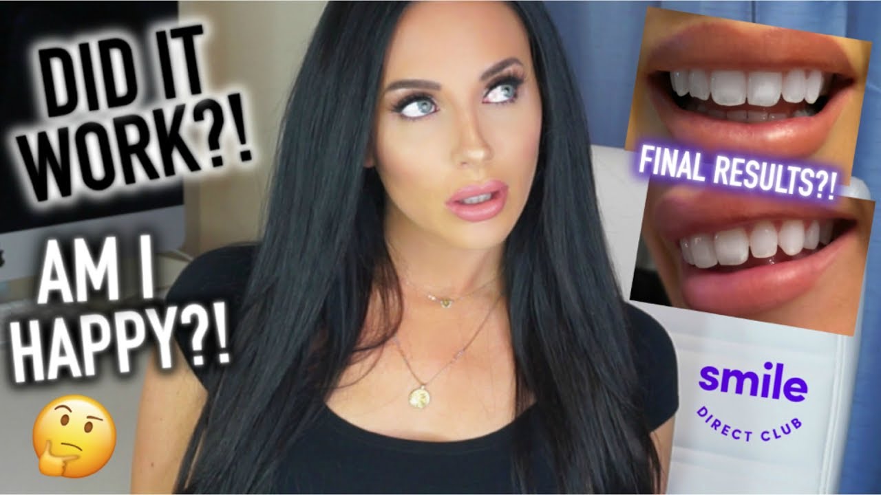 Smile Direct Club | FINAL RESULTS + END OF TREATMENT UPDATE
