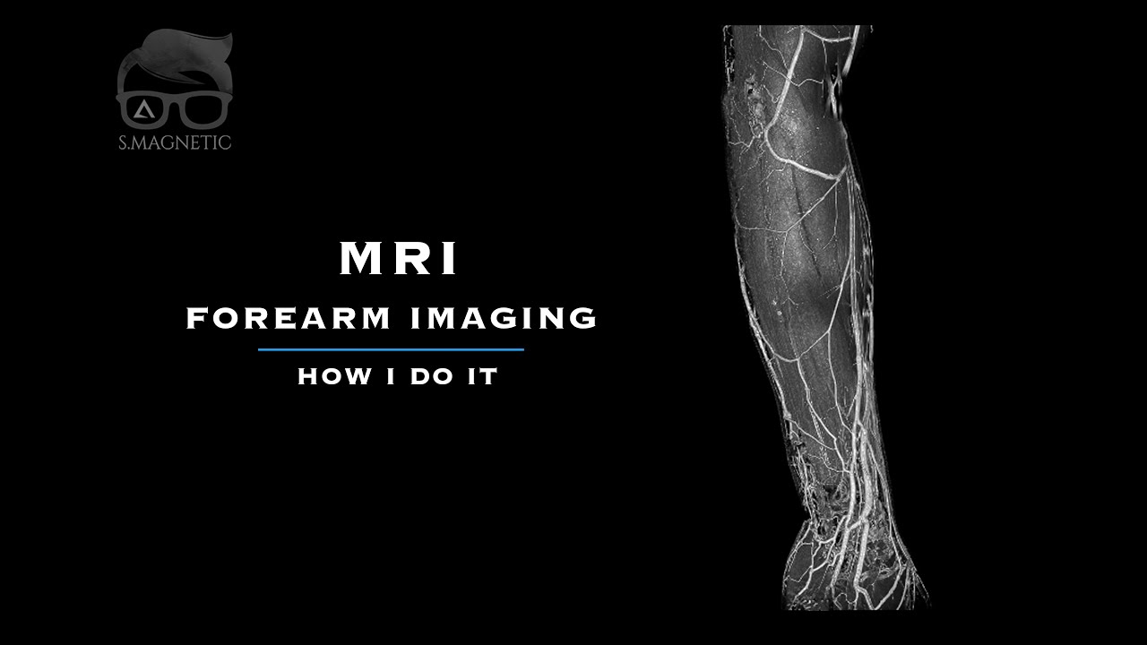 MRI FOREARM IMAGING – How I Do It