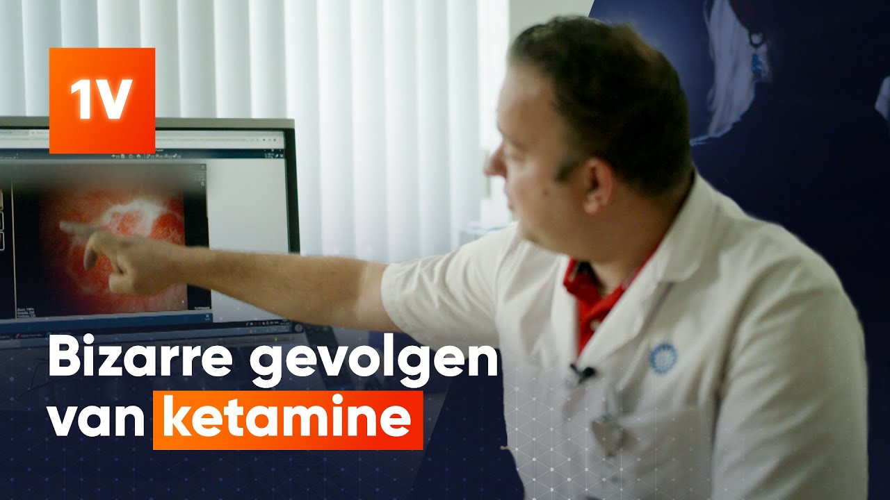 Meer jongeren met ernstige blaasproblemen door gebruik ketamine