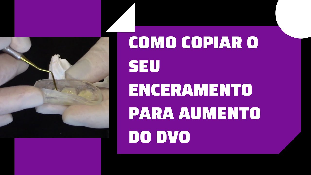 COMO COPIAR O SEU ENCERAMENTO PARA AUMENTO DO DVO| DIRCE NASCIMENTO