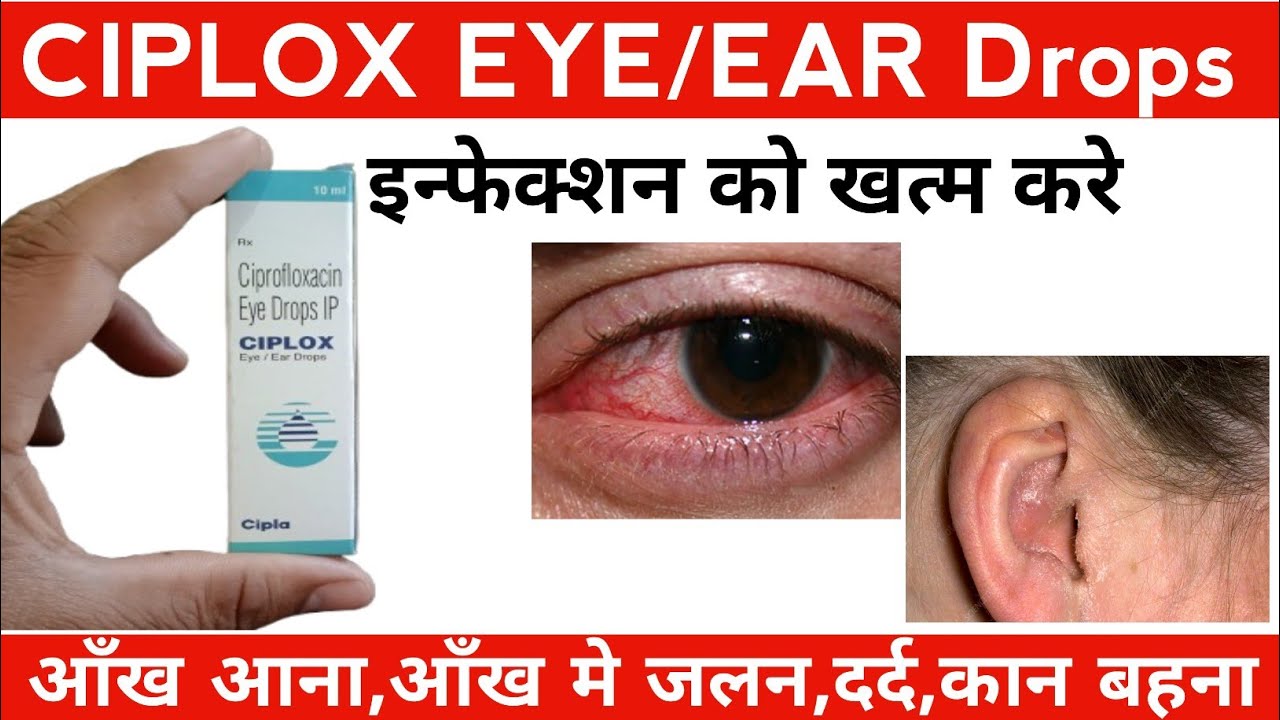 Ciplox Eye drops|Ciplox Eye/Ear drops|Ciplox Ear drops|Ciprofloxacin Eye drops