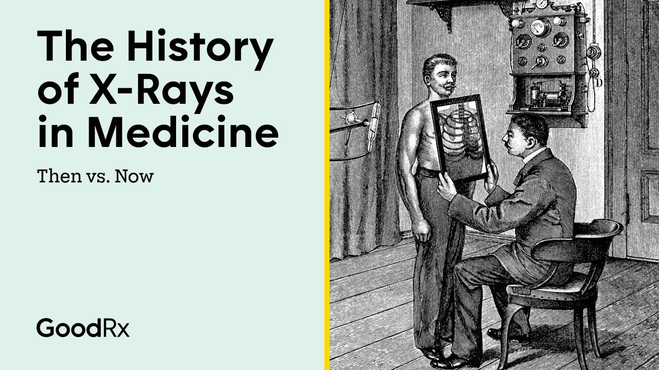The History of X-Rays in Medicine | Then vs. Now | GoodRx