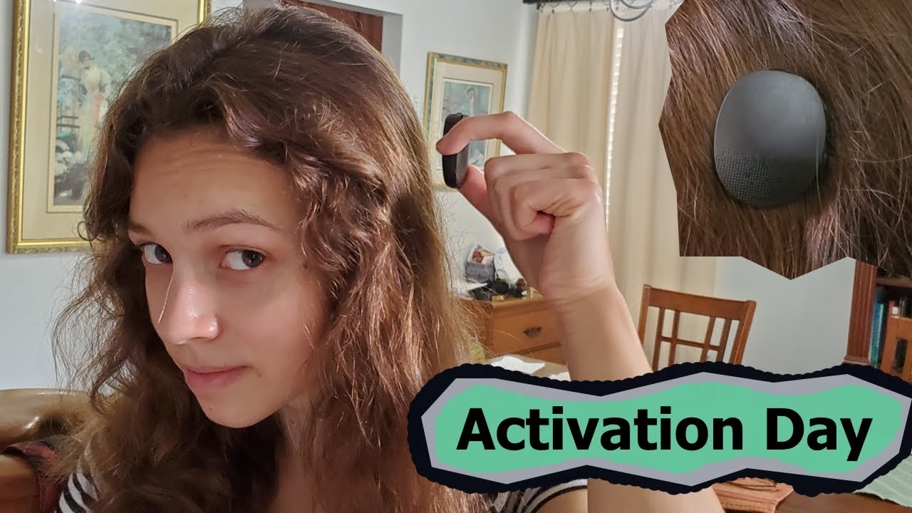 Having My Cochlear Implant Activated