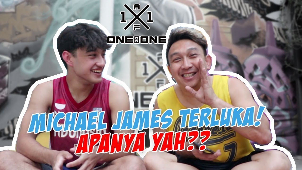 Michael James terluka! Apanya yah??