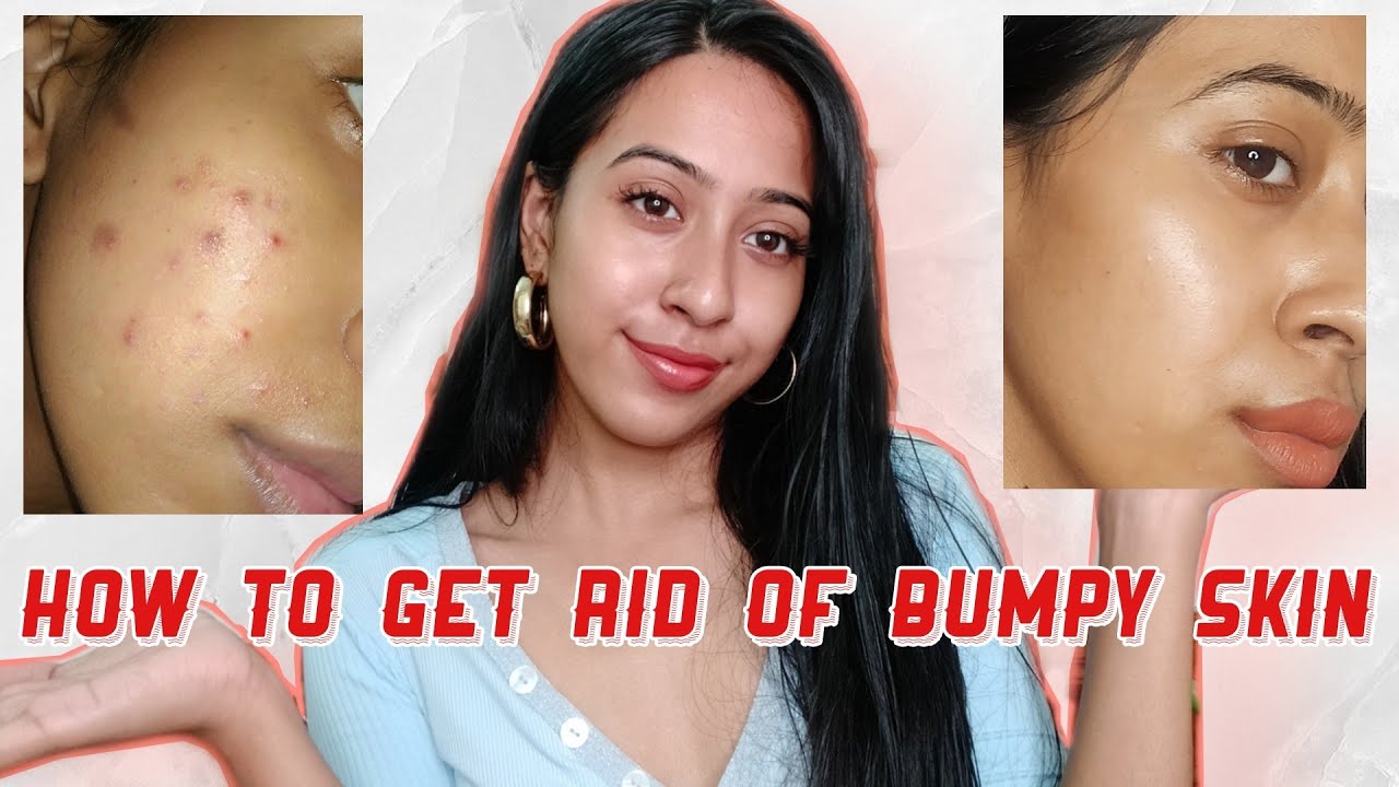 How to get rid of Small Tiny Bumps and Textured Skin (Using Affordable Products)