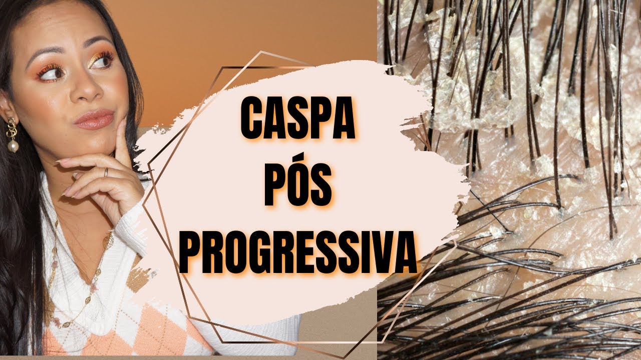 😭DESCAMAÇÃO PÓS PROGRESSIVA PODE DAR QUEDA INTENSA😫