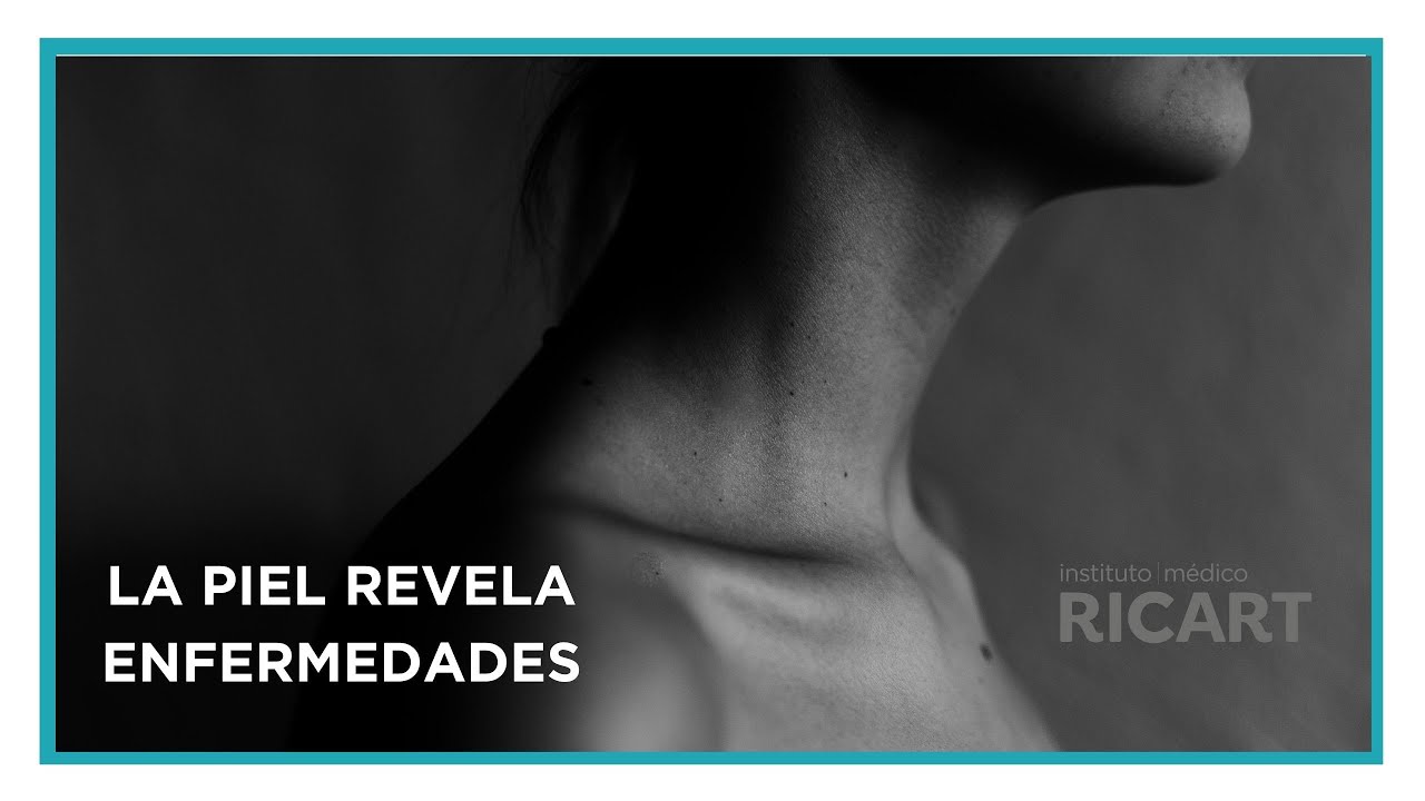 La piel revela enfermedades - Unidad de Dermatología de Instituto Médico Ricart