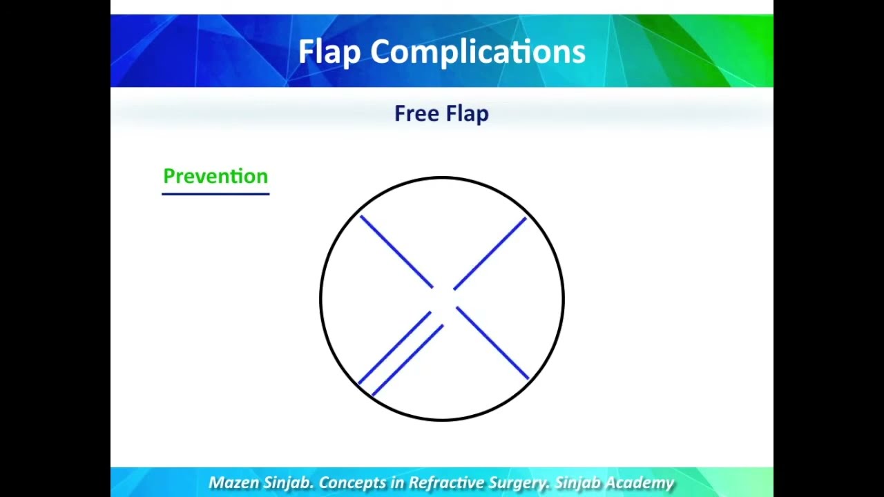 Concepts in Refractive Surgery: Part 7