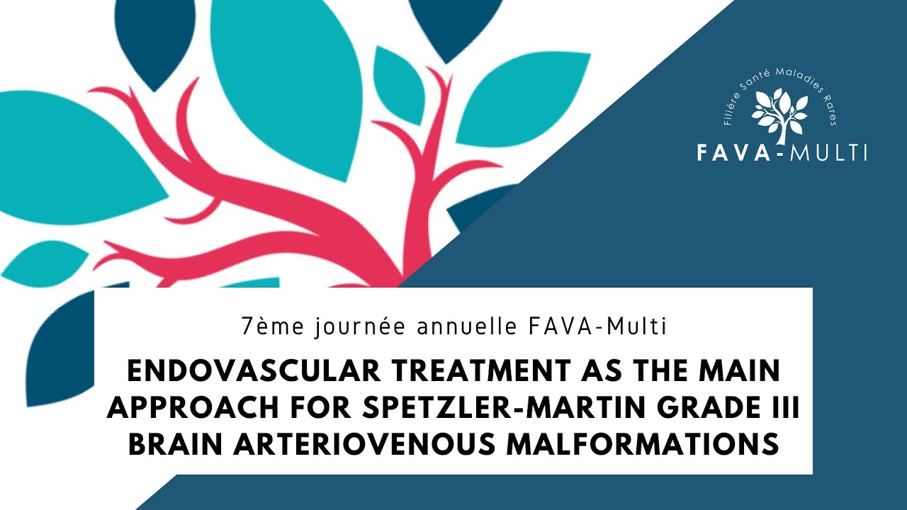 Le traitement endovasculaire comme approche principale des MAV c&eacute;r&eacute;brales grade III Spetzler-Martin