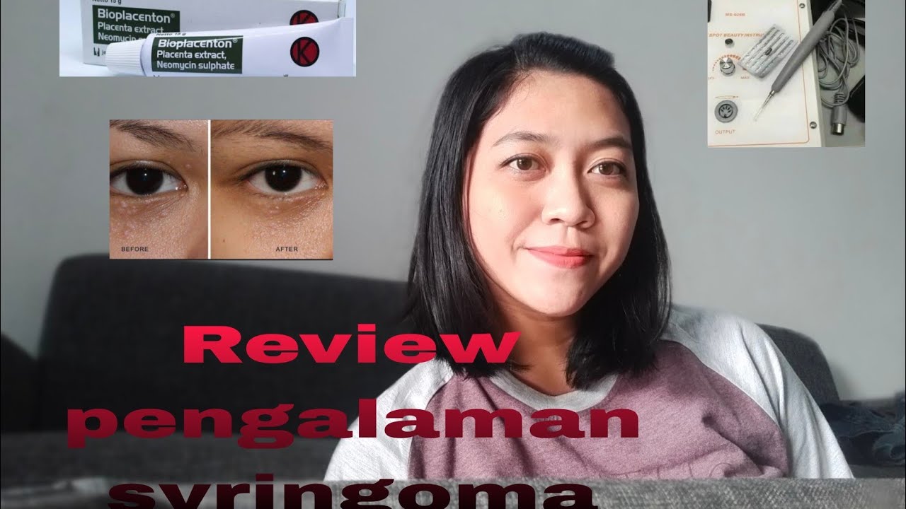 Review pengalaman syringoma