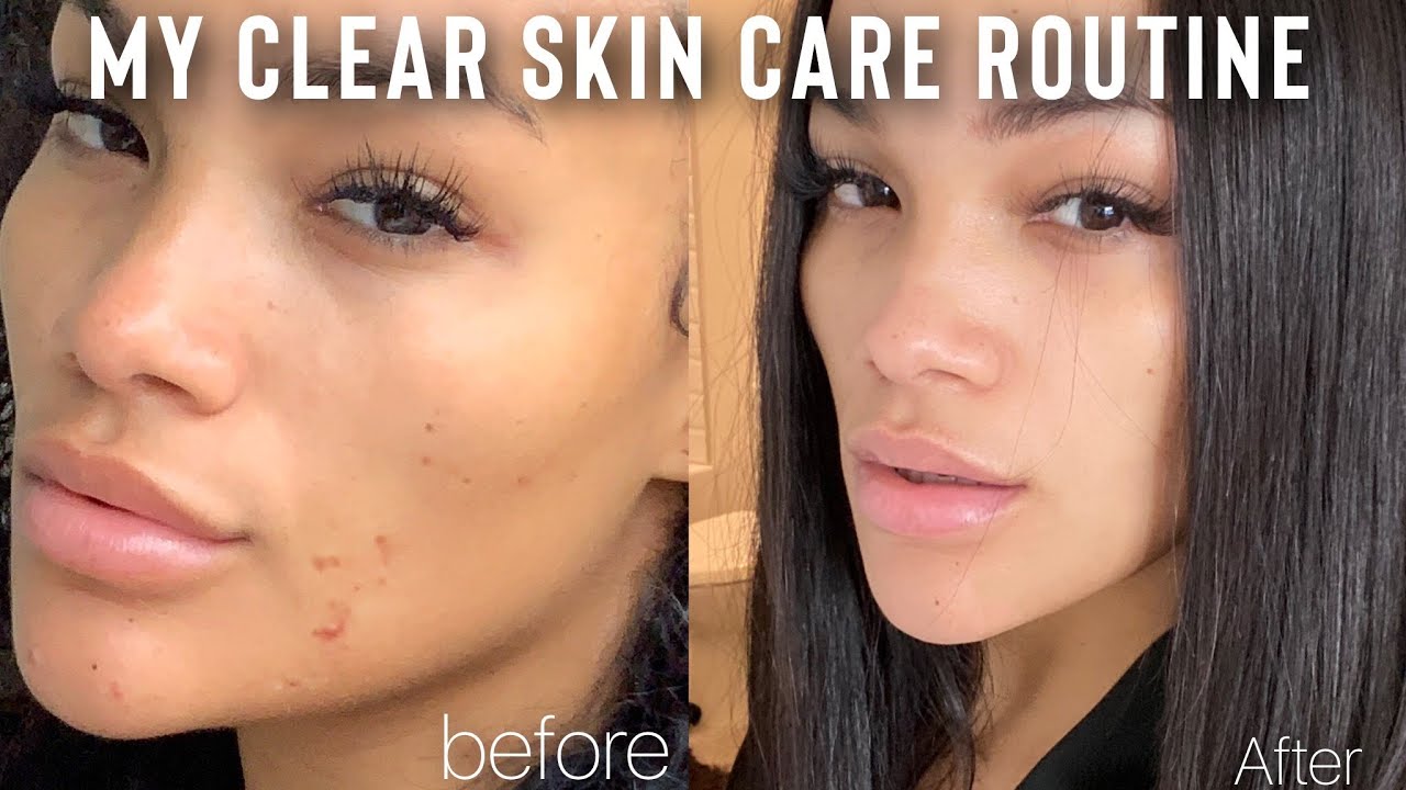 MY CLEAR SKIN CARE ROUTINE 2020 | HOW I CLEARED MY SKIN EASY! | ALLYIAHSFACE