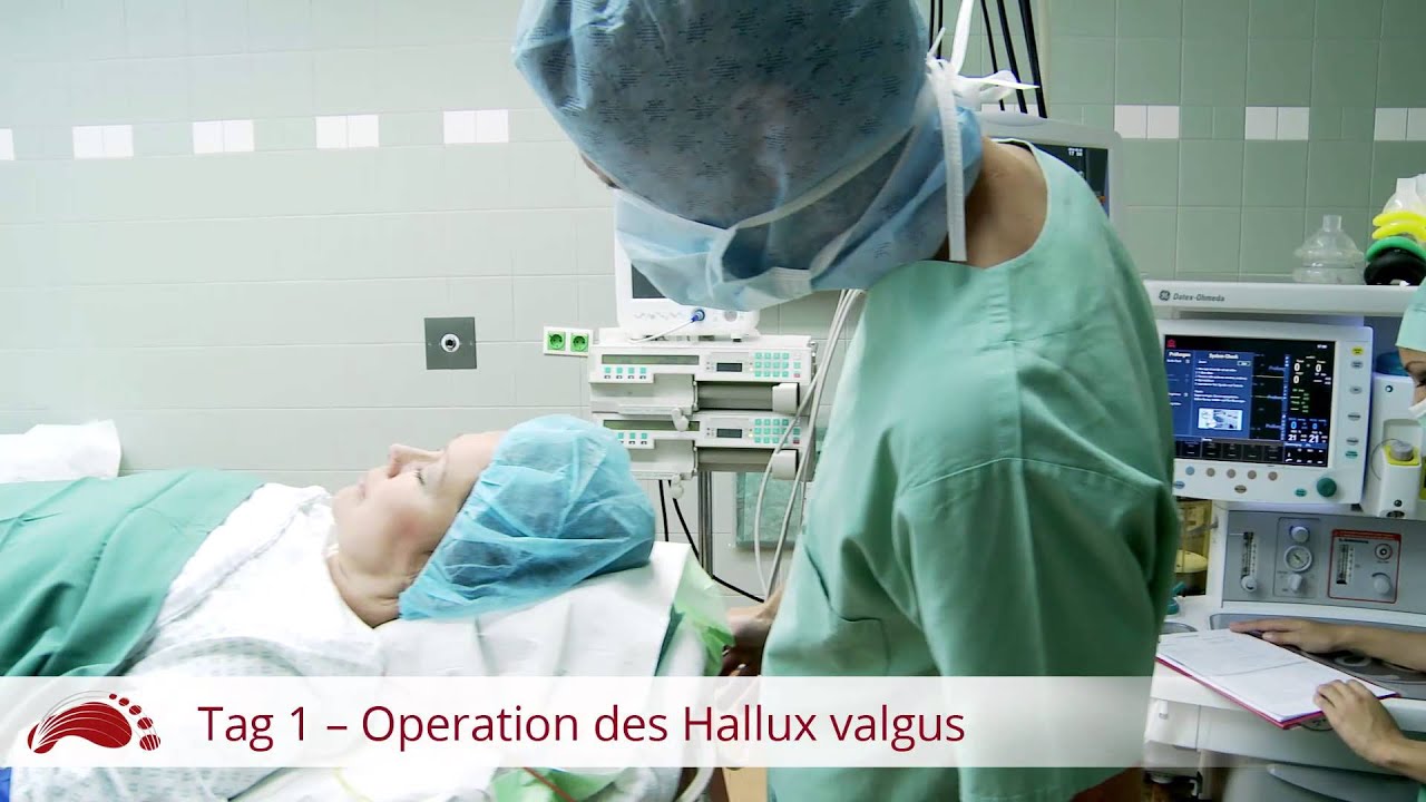Fußoperation des Hallux Valgus