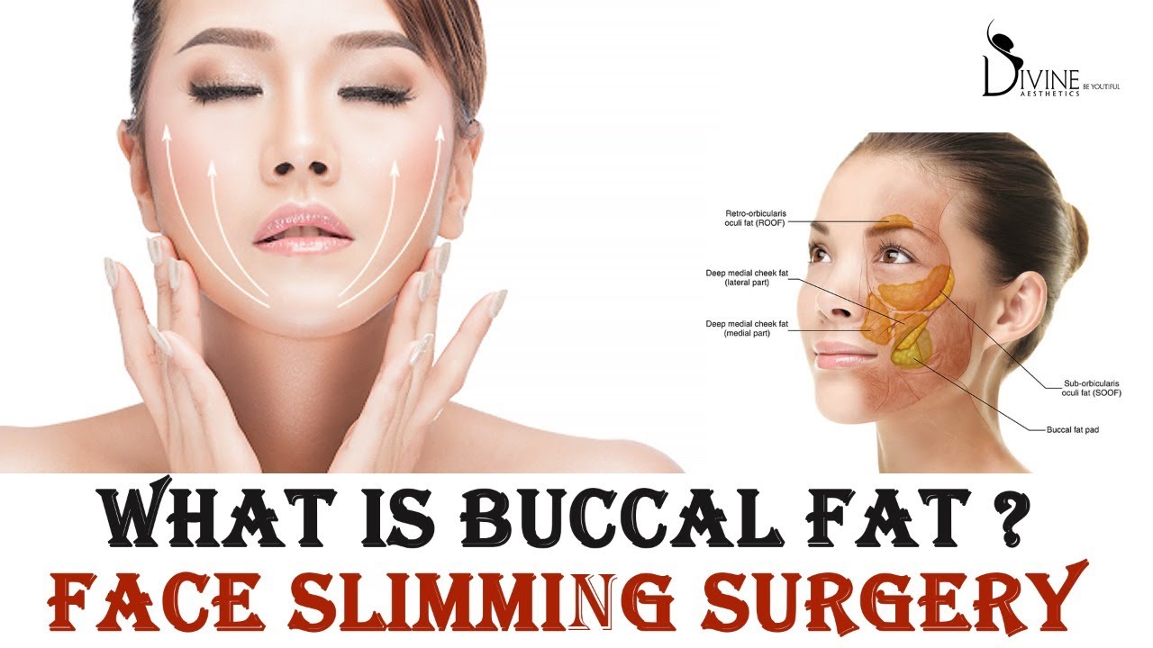 A to Z Buccal Fat | What Is Buccal fat ? Face Slimming Surgery