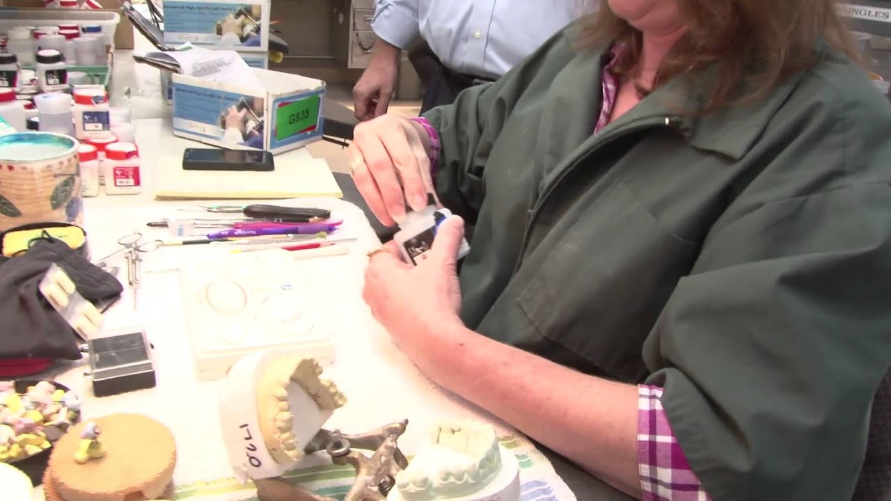 EB3 Experience Burdette Dental Story