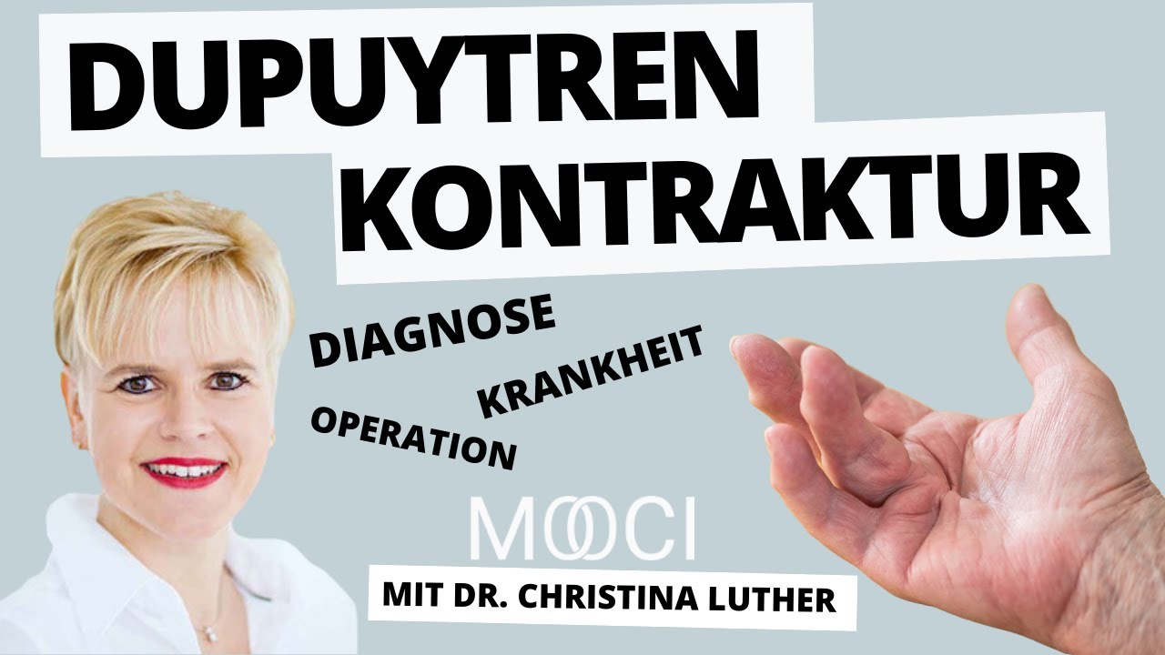 Was ist eine Dupuytren Kontraktur?