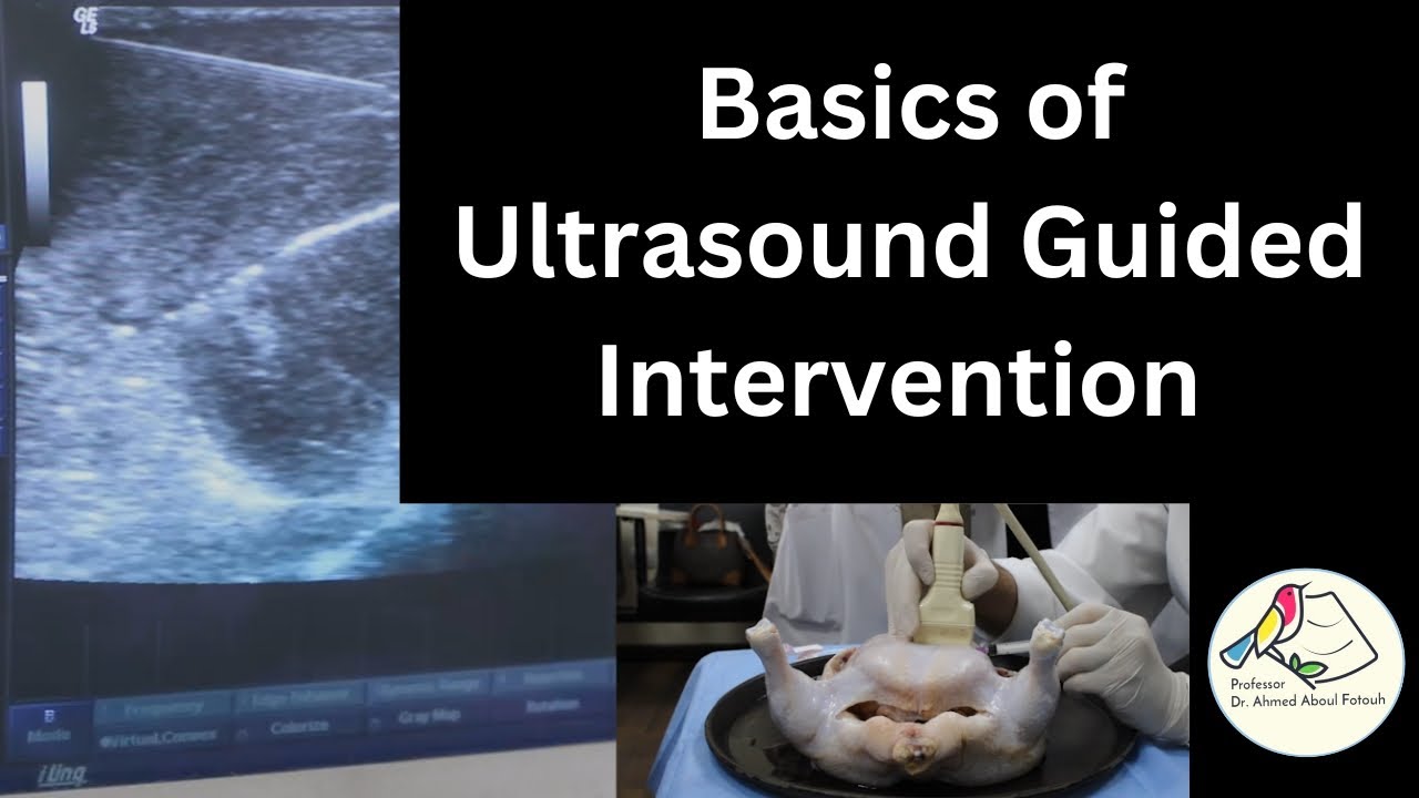 Basics of Ultrasound guided intervention - In-plain & out of plain methods