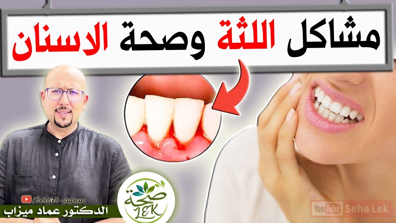 وصفة لمشاكل اللثة وصحة الاسنان / وصفات الدكتور عماد ميزاب Doctor imad mizab