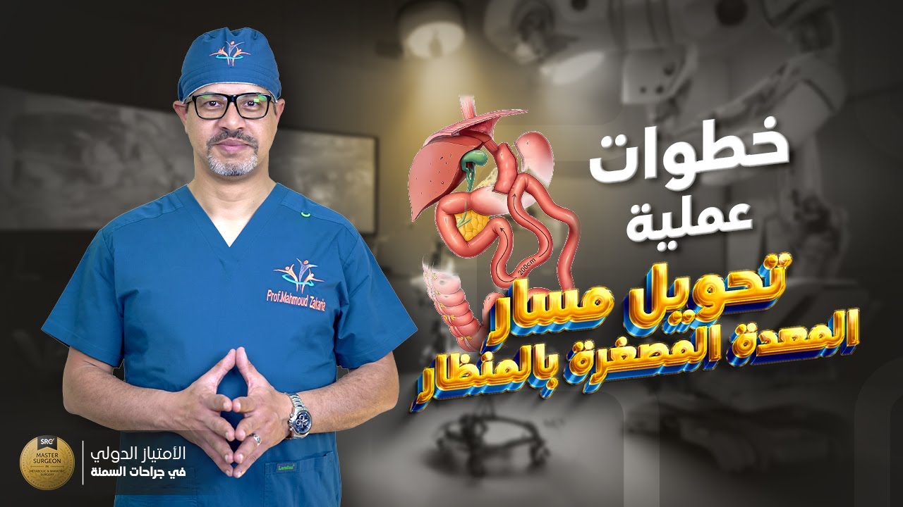 يعني ايه عملية تحويل المسار المصغرة و ايه أهم النقاط اللى لازم الجراح يلتزم بها لنجاح العملية؟ 👇🏻