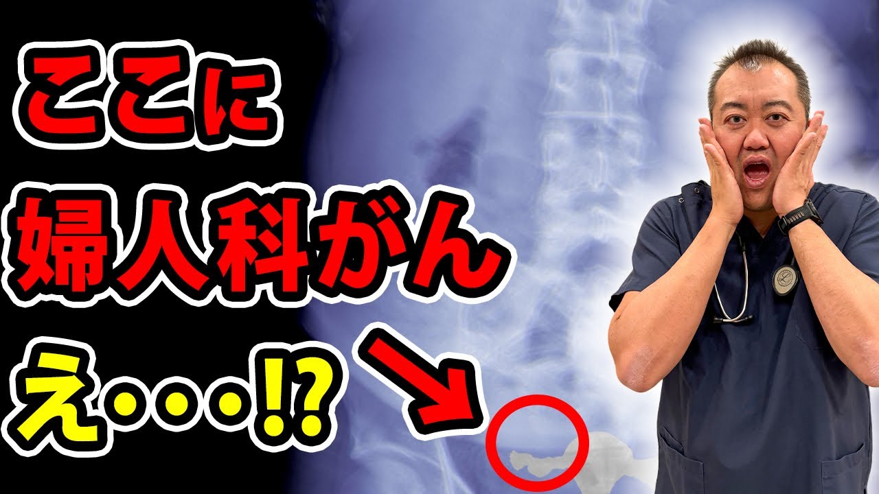 【要注意】9割の人が知らない卵管にできるがんについてお話します！