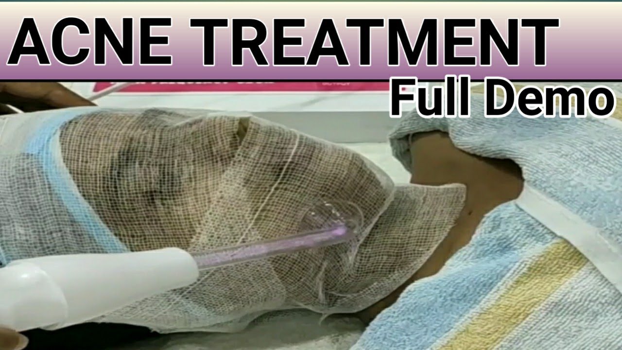 ब्यूटी पार्लर कोर्स क्लास 49 ACNE TREATMENT with High Frequency full demo. प्रोफेशन ब्यूटीशियन कोर्स