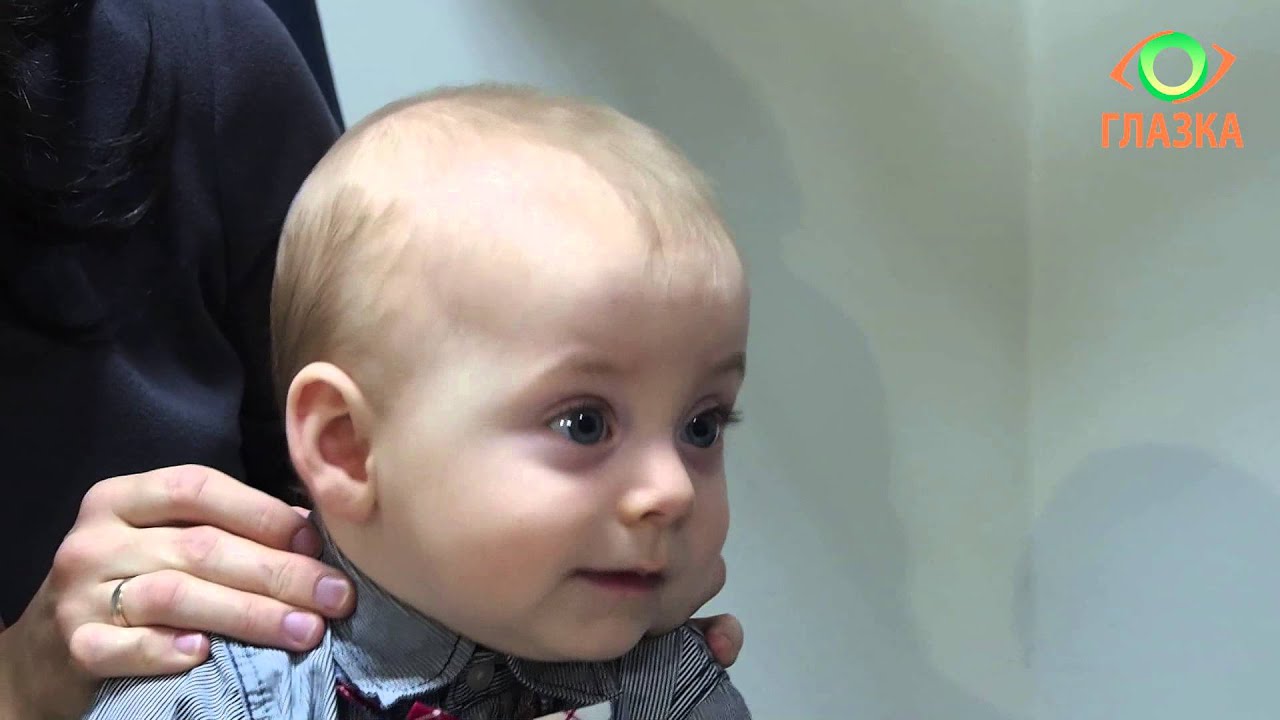 Диагностика зрения детей до года
