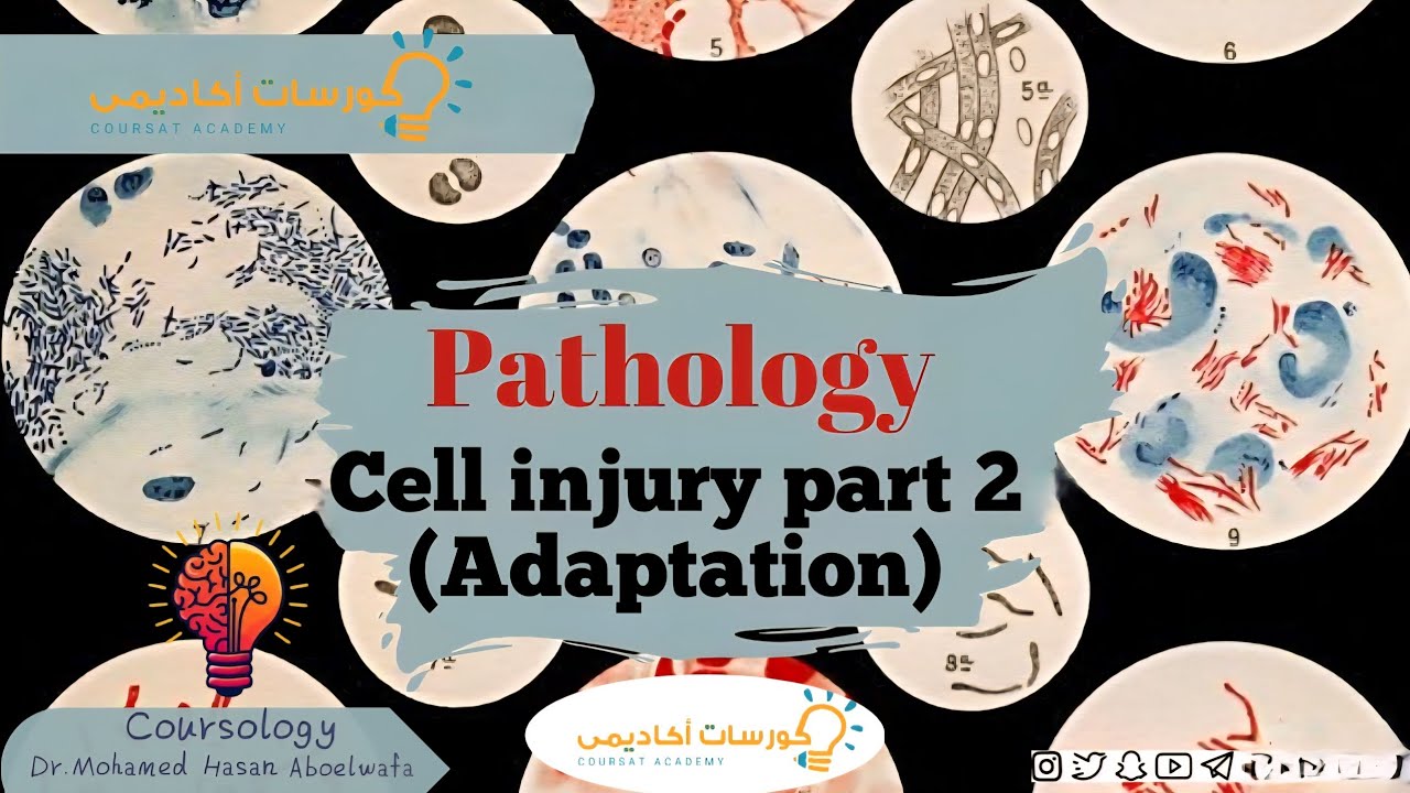 Cell injury part 2 (adaptation --Hyperplasia -- Hypertrophy -- Atrophy -- Metaplasia)
