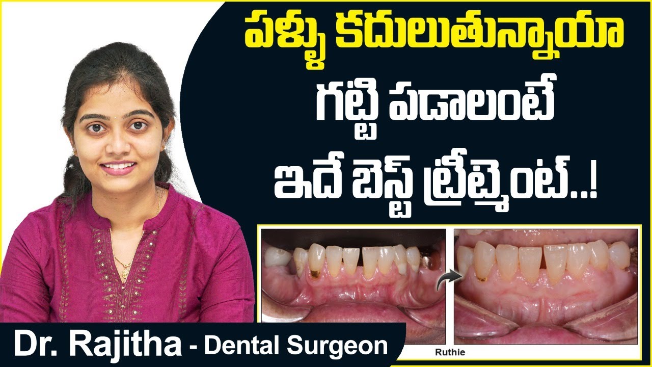 ఊగే పళ్లకు ట్రీట్మెంట్ | How to Tighten Loose Teeth Naturally in Telugu | Eledent Dental Hospitals