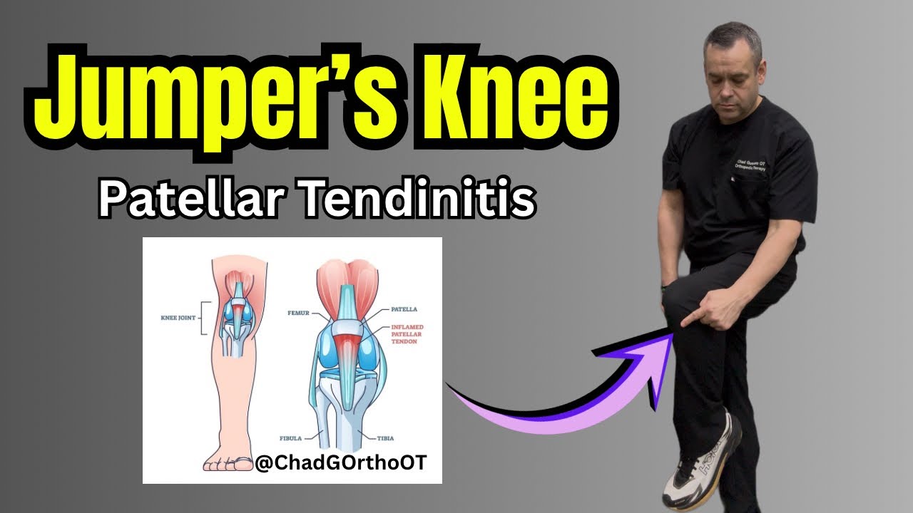 Jumper’s Knee (Patellar Tendonitis) Rehab Exercises & Pain Relief 