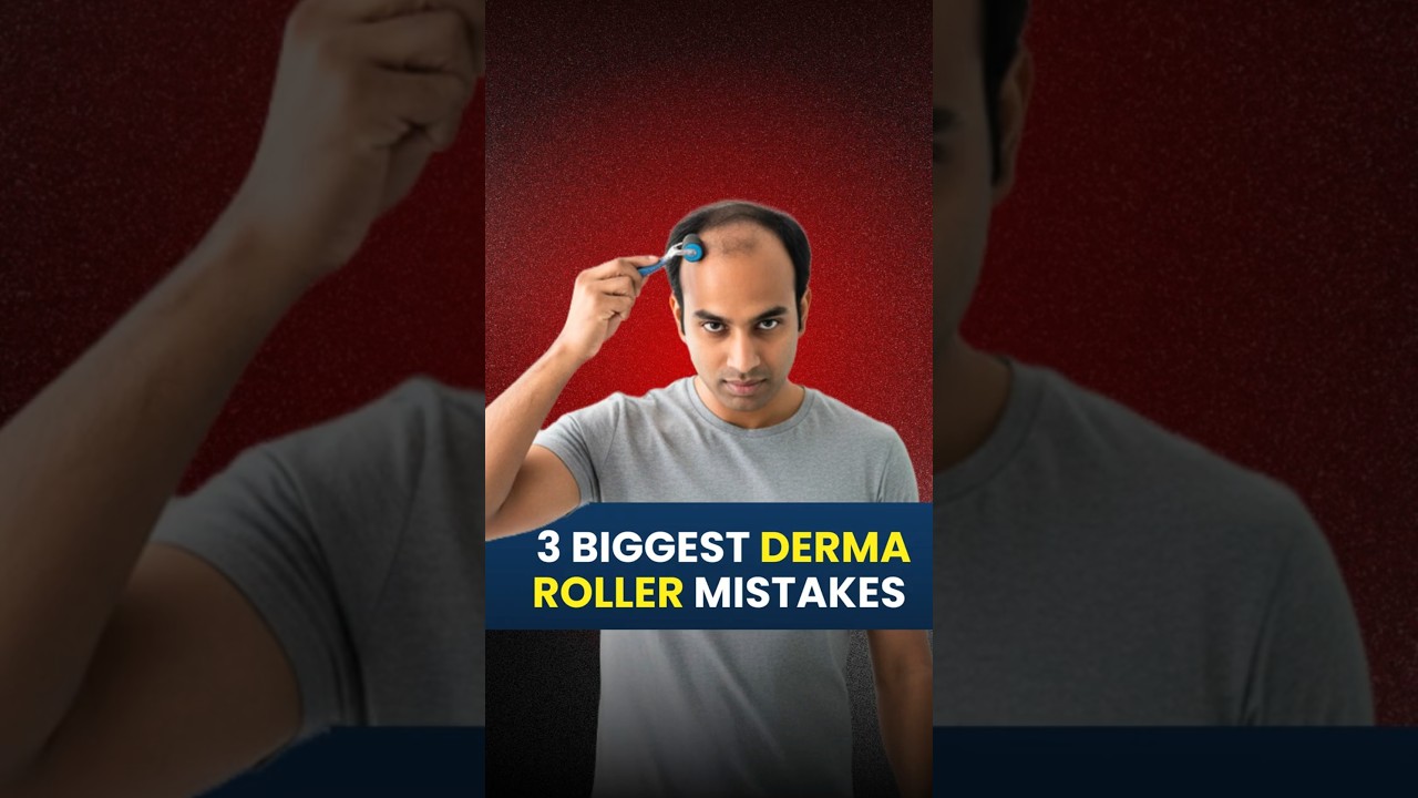 3 biggest Derma roller mistakes,  That could make&nbsp;you&nbsp;bald | Hair Loss | Hair Regrowth #waidonAI