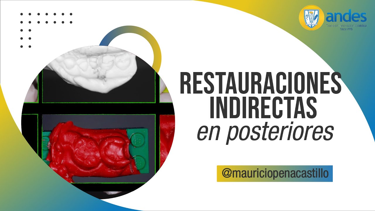 ¿Cómo hacer un modelo elástico y no morir en el intento?
